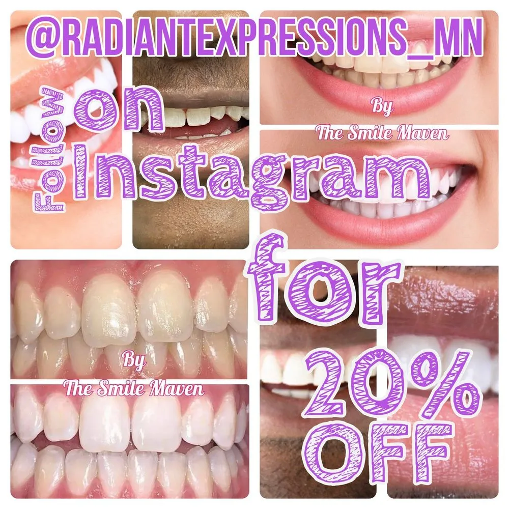 30908 teeth whitening stpaulmn before after