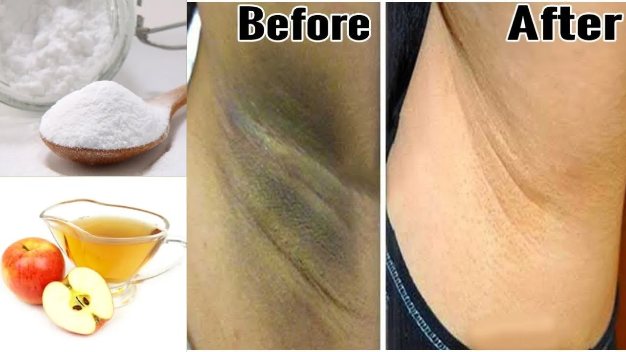 30912 baking soda lemon scrub