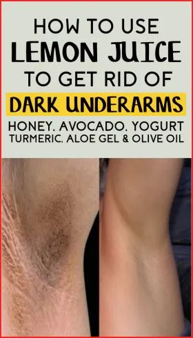 30912 deodorant irritation