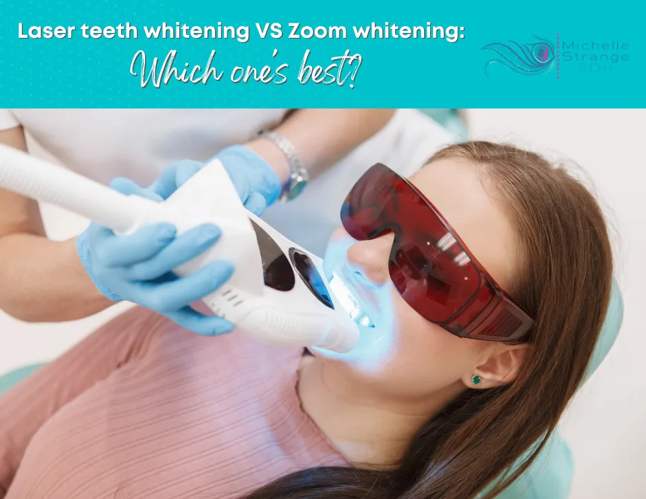 30921 teeth whitening comparison