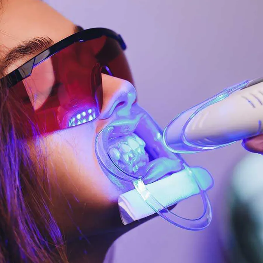 30922 laser teeth whitening clinic hcmc