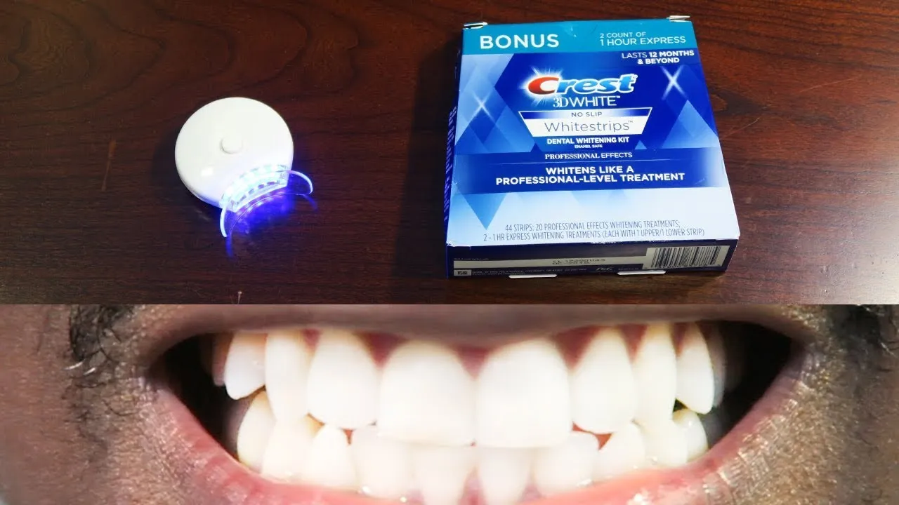 30924 professional teeth whitening