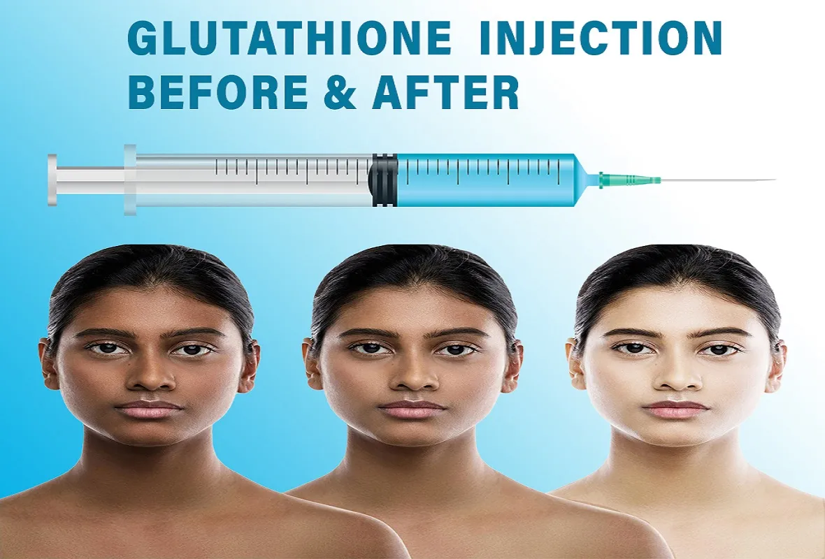 30926 glutathione injections