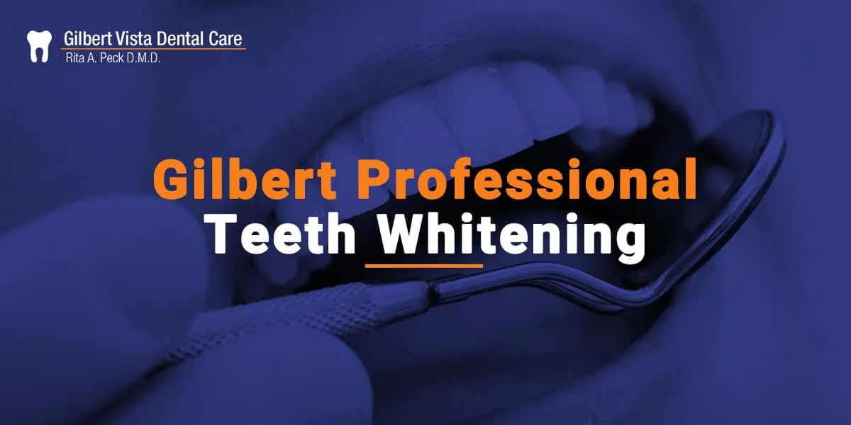 30934 professional teeth whitening