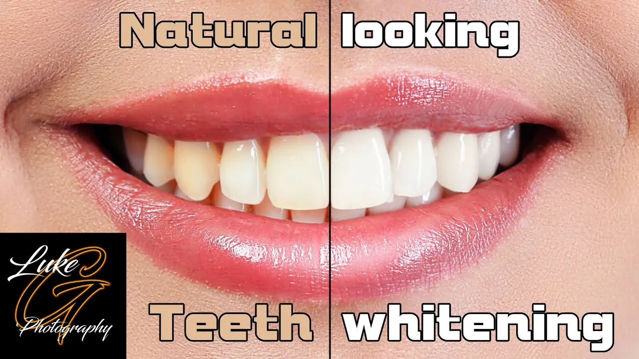 30942 fasting teeth whitening steps