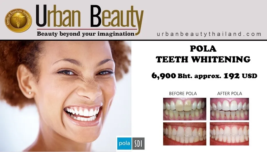 30960 teeth whitening procedure