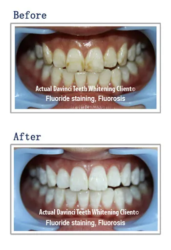 30963 dental checkup