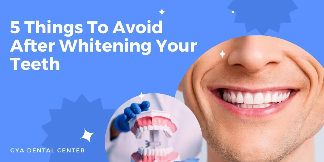 30973 red wine teeth