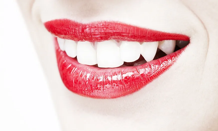 /img/30976-teeth-whitening-deals-comparison.webp