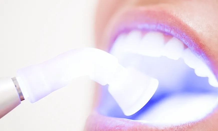 30976 teeth whitening deals