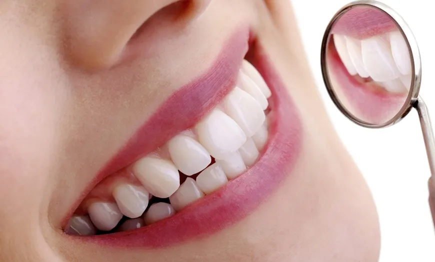 30976 teeth whitening post care