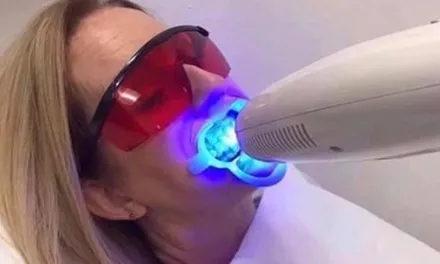 30976 teeth whitening pre care