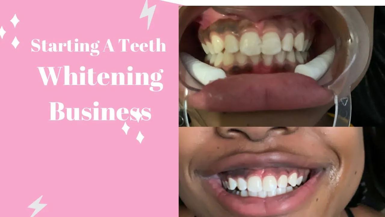 30977 market demand teeth whitening