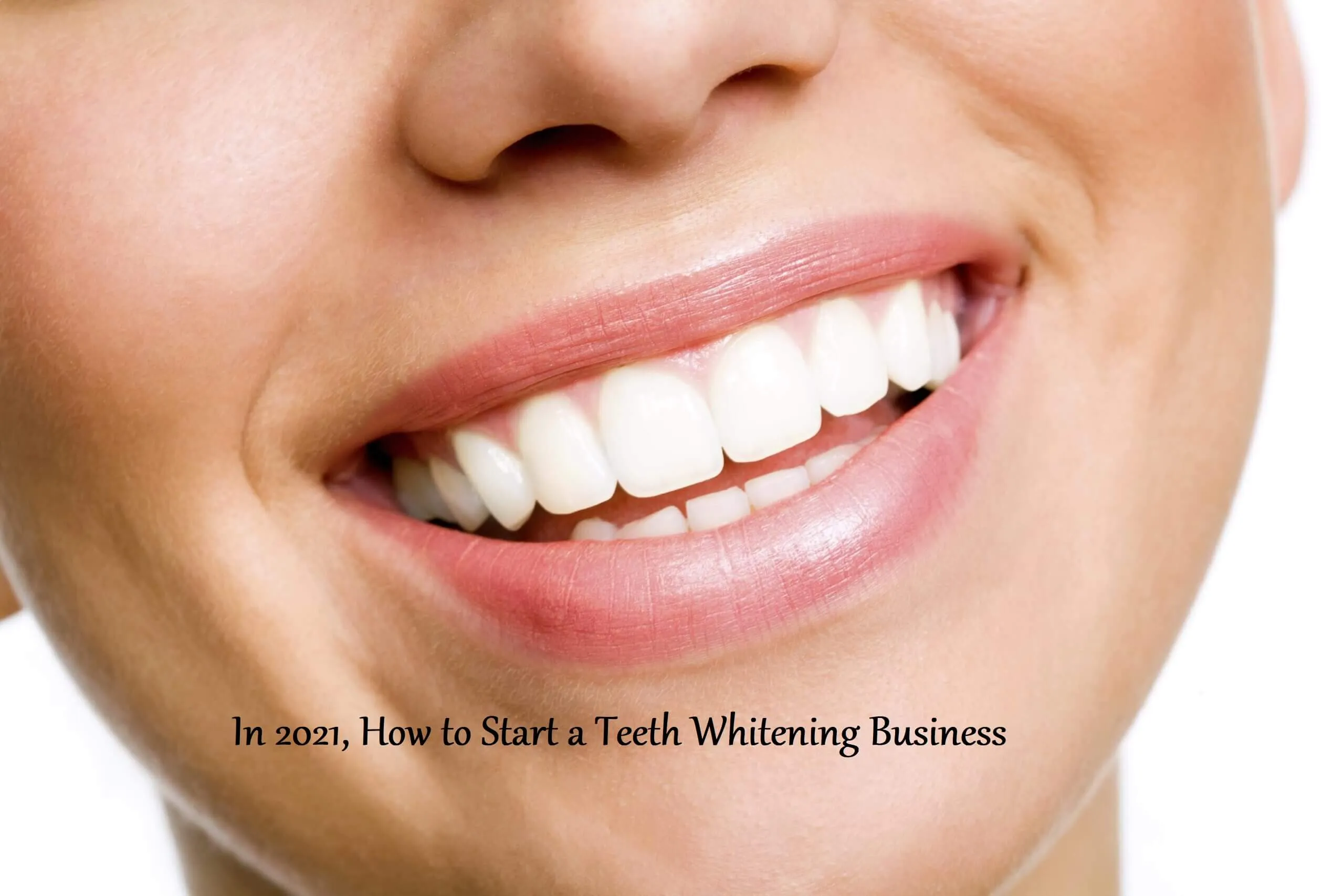 30977 teeth whitening business plan