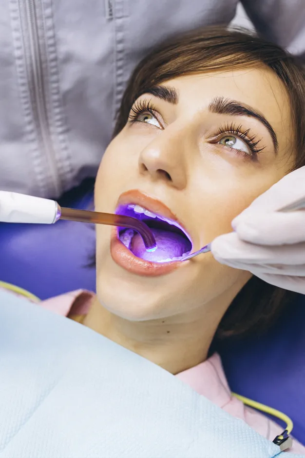 30979 teeth whitening options