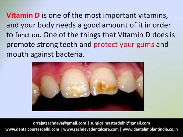 30980 vitamin d teeth whitening image4