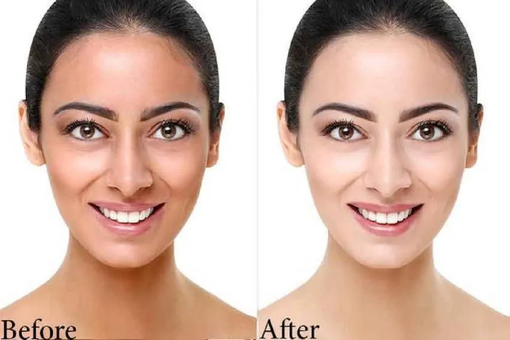 30994 intimate whitening before after