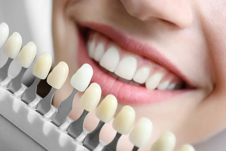 /img/31010-teeth-whitening-maintenance.webp