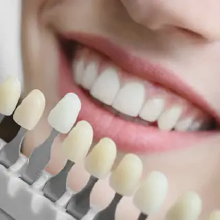 /img/31010-teeth-whitening-maintenance.webp