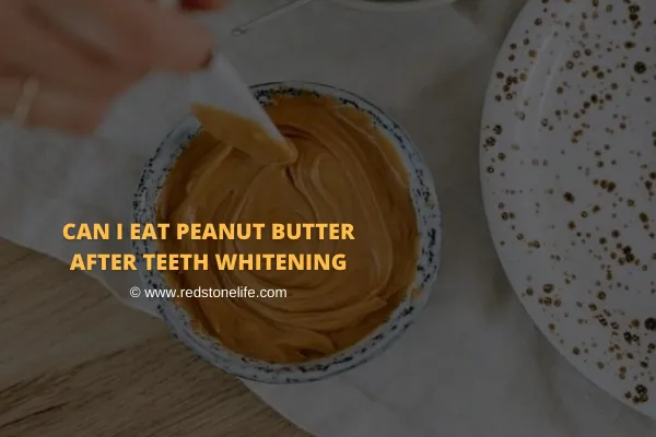 31024 teeth whitening