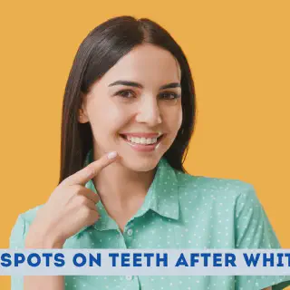 /img/31031-teeth-whitening-spots-cause.webp