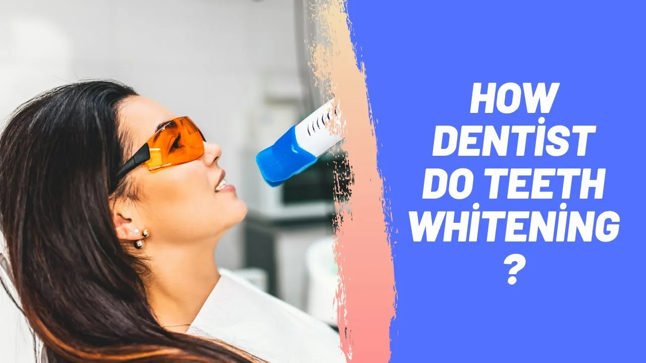 31033 at home teeth whitening