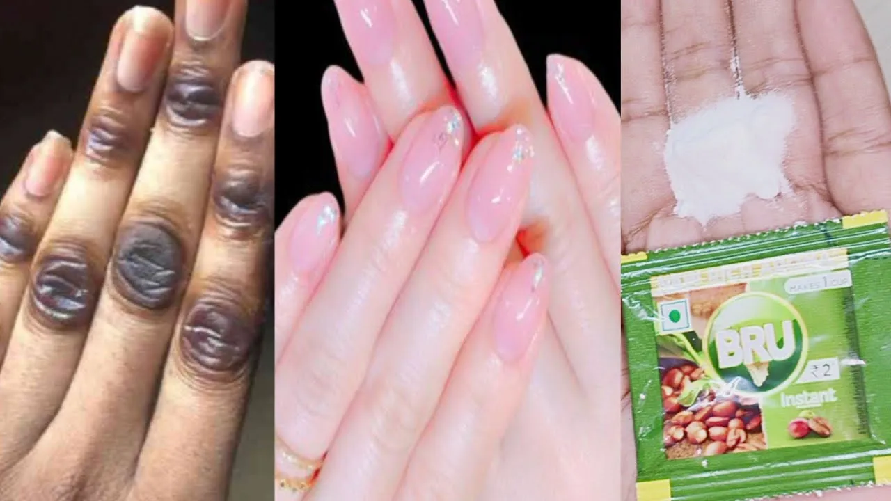 31044 hands whitening before after