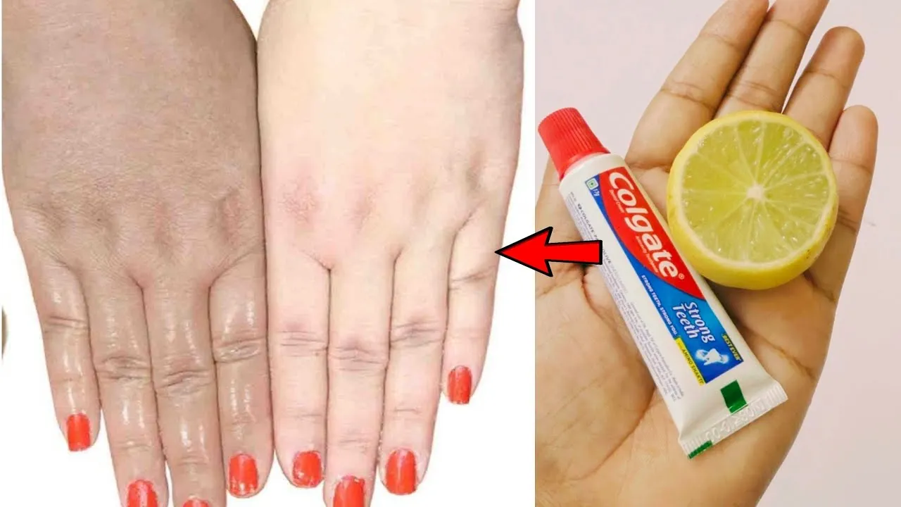 31044 turmeric yogurt pack