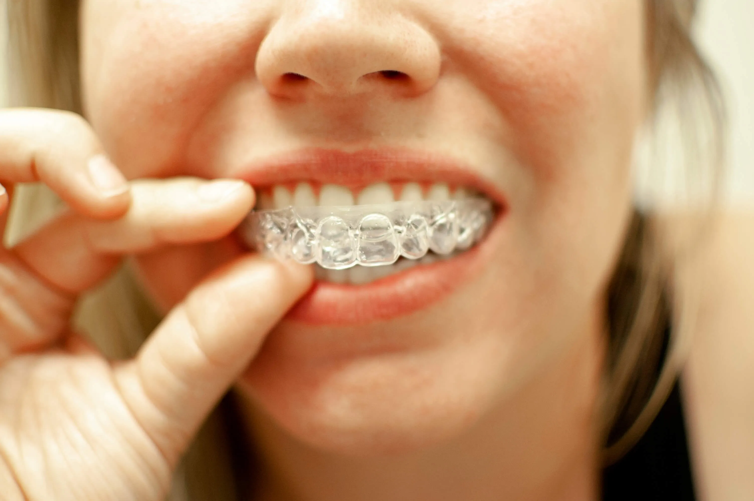 31045 foods drinks whitening