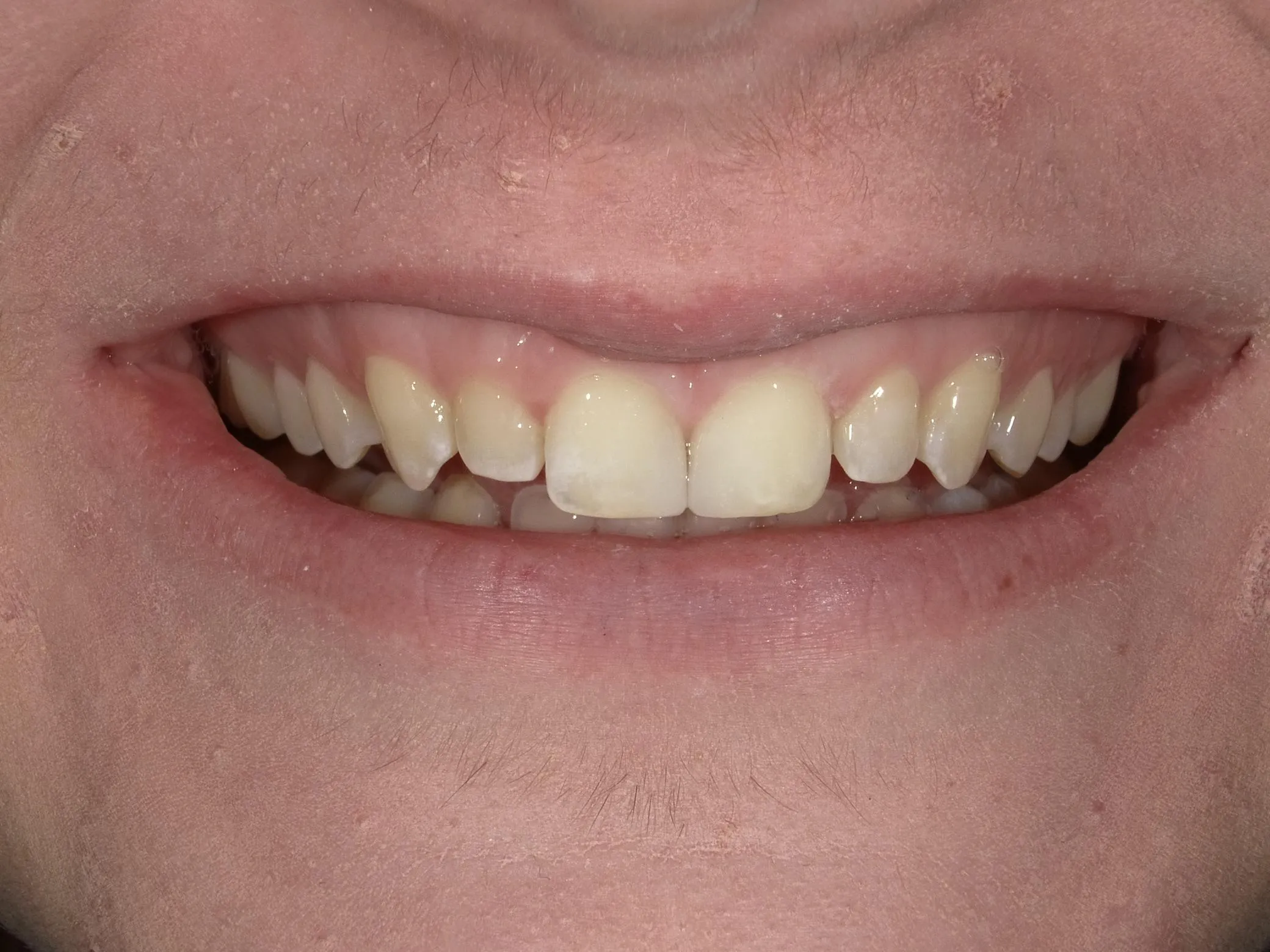 31048 brushing flossing