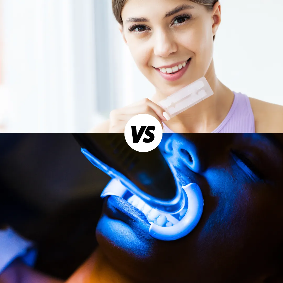 31062 laser teeth whitening procedure