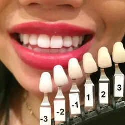 31064 teeth whitening denver